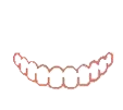 Dessin orthese original removebg preview 1