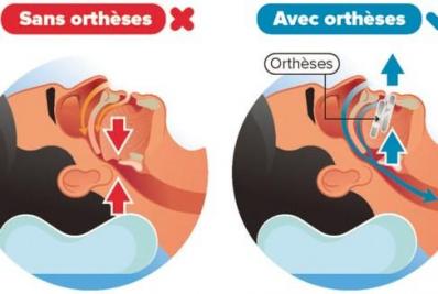 Ortheses